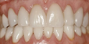 Dental Photos 89113