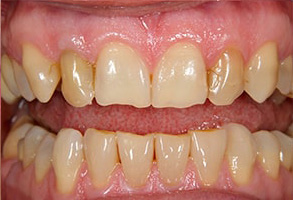 Enterprise Before and After Dental Images