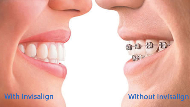 https://www.rhodesranchdentalonline.com/images/dental-library/invisalign-dentist.jpg