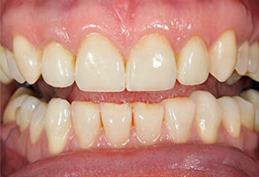 Rhodes Ranch Dental Images